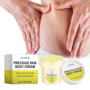 Stretch mark care cream Pregnant women Skin care